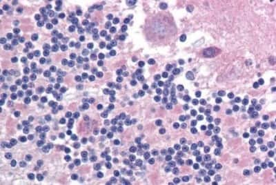Immunohistochemistry-Paraffin: IGSF4D/SynCAM2/CADM2 Antibody [NBP3-14375] - Immunohistochemistry of formalin-fixed, paraffin-embedded human cerebellum after heat-induced antigen retrieval.